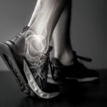 Ankle Injuries and Everything You Need to Prevent Them