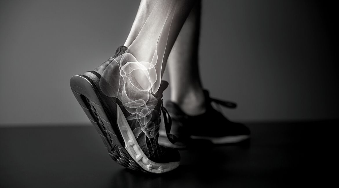 Ankle Injuries and Everything You Need to Prevent Them