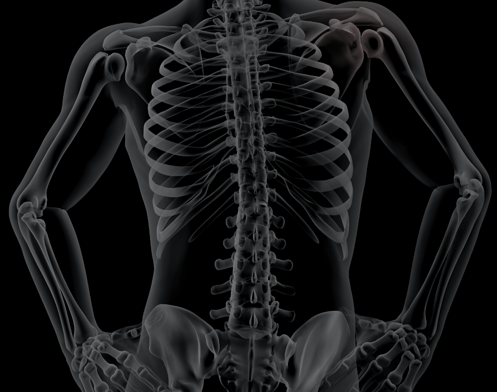 Bruised Ribs Broken Ribs Causes, Symptoms, Treatment and Prevention